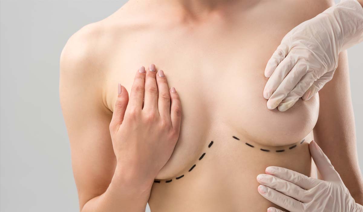 Doctor Gabriel Cubillos: Pexia mamaria en Santiago de los Caballeros (República Dominicana)